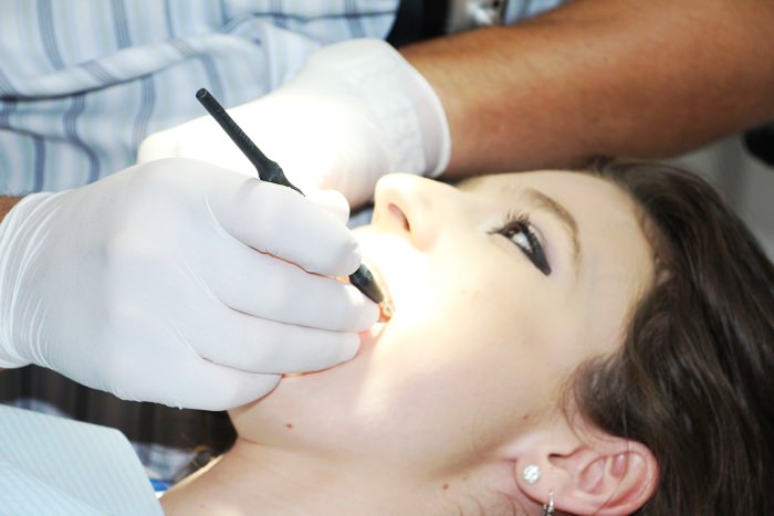Applying composite resin fillings