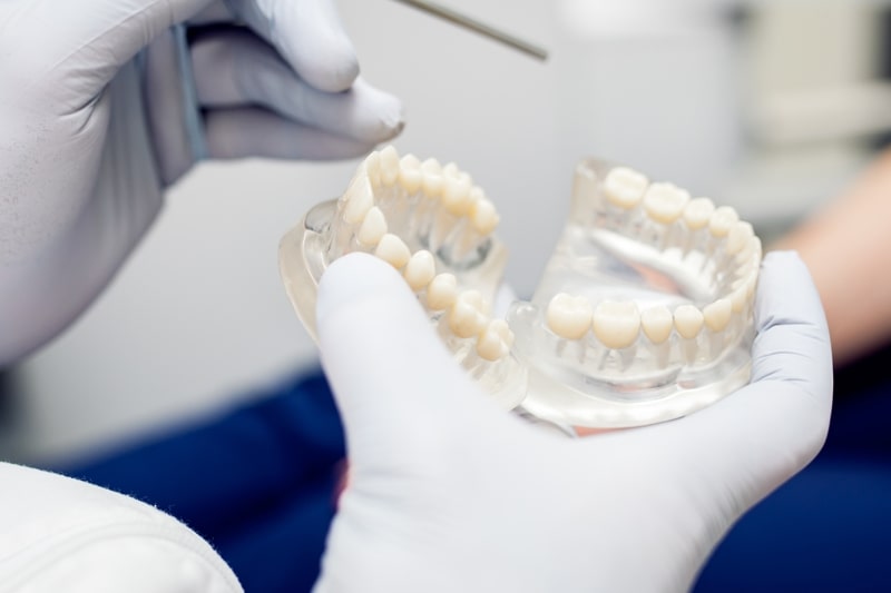 Dentist explaining dental implants