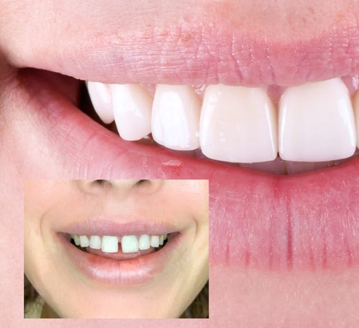 before-after-procedure-gallery